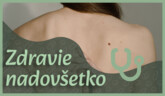 Vyšetrenie znamienok | Zdravie nadovšetko