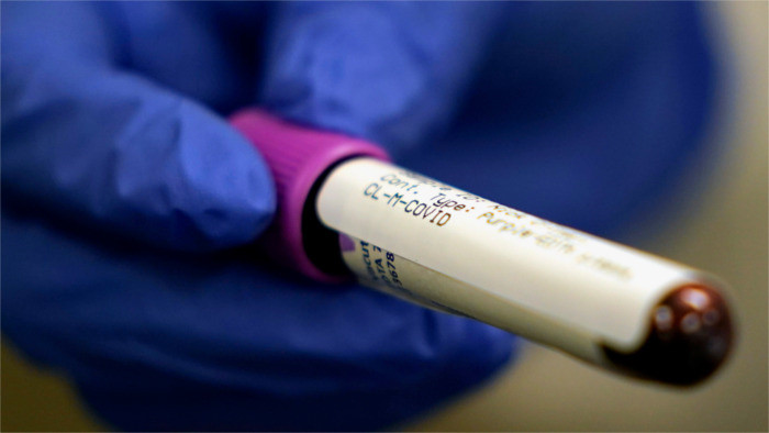 Covid-19 : 24 nouveaux cas enregistré en Slovaquie