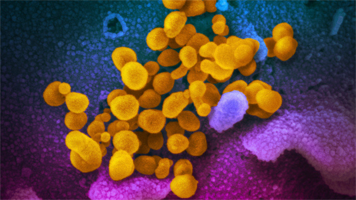 Virologists isolate the first Slovak strains of the novel coronavirus