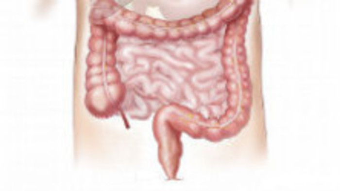 Antinutrienty