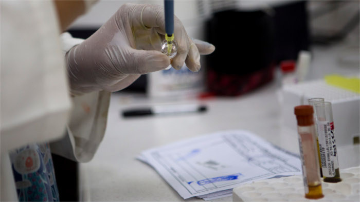 Immunologische Situation der Slowaken überprüft