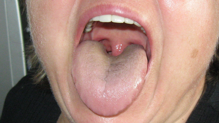 Svetový kongres Esperanta bude mať vlastnú známku