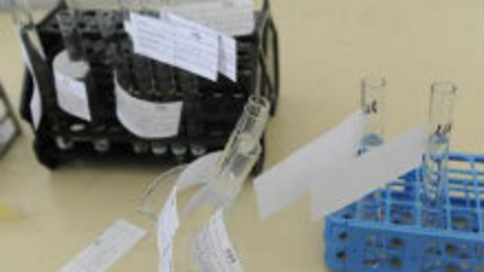 Rozbory vody počas Svetového dňa vody