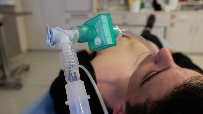 Prevratná umelá pľúcna ventilácia