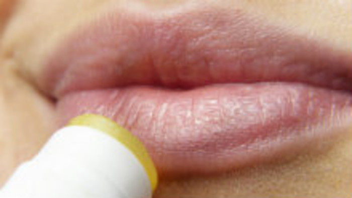 Herpes - príčiny