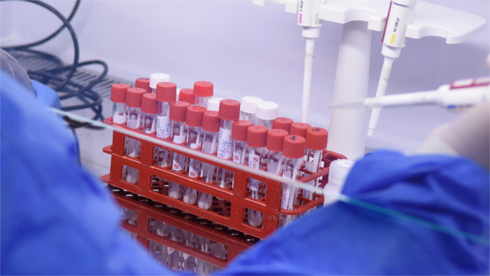 Covid-19 : 101 nouveaux cas en Slovaquie