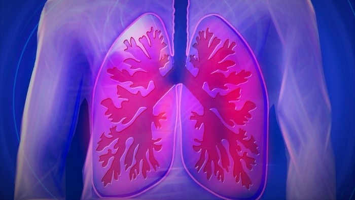 Onkologická diagnostika pľúc