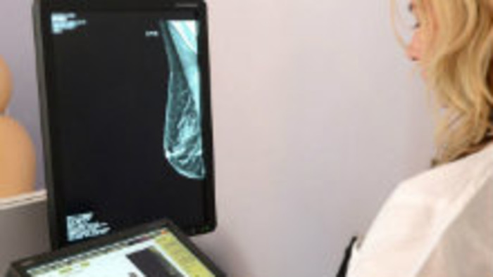 Nitrianska mamografia získala ocenenie za kvalitu
