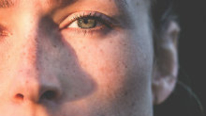 Rosacea - Ružovka