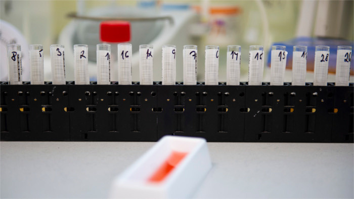 COVID-19 : 14 morts en Slovaquie