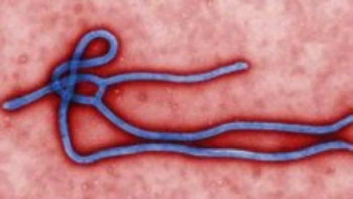 Slovakia prepared to fight Ebola