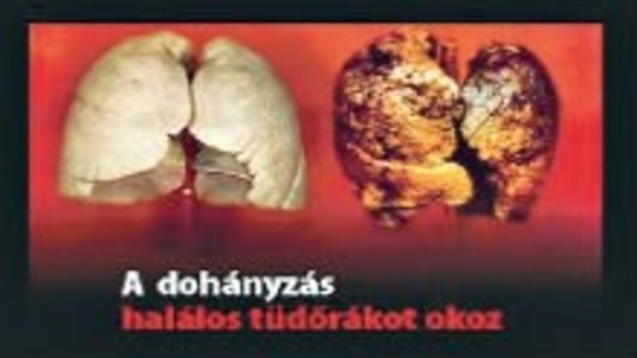 Elrettentő cigisdobozok az unióban