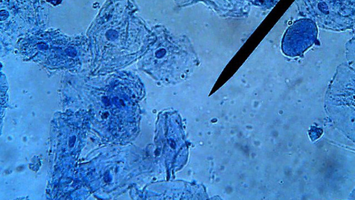 Bacterial cell division and the search for new antibiotics