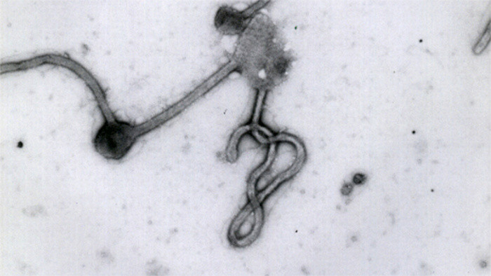 Eslovaquia se suma a la iniciativa de lucha contra las enfermedades raras  