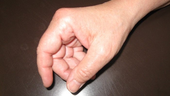Choroby našich predkov a choroba súčasnosti