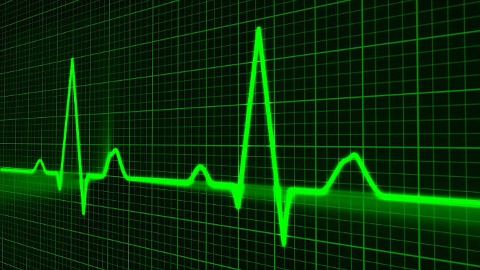 Mozgová príhoda je zložitejšia než infarkt