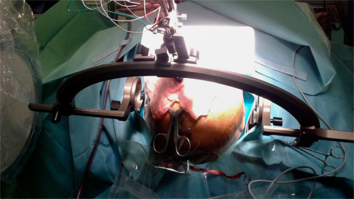 Here is your scalpel, Miss