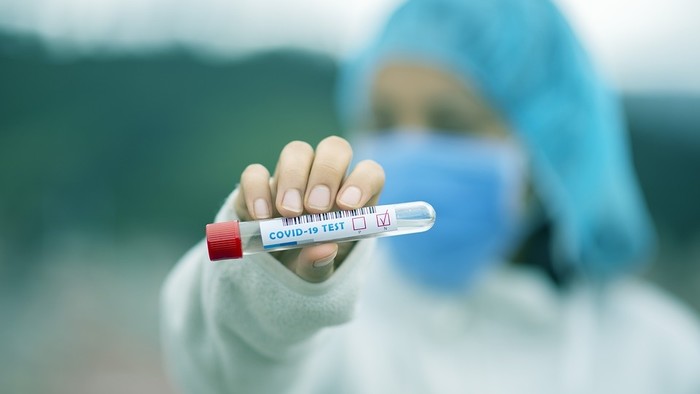 K veci: Plošné testovanie na COVID-19 