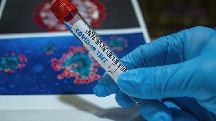 Celoplošné testovanie môže Slovákov rozdeliť do troch skupín