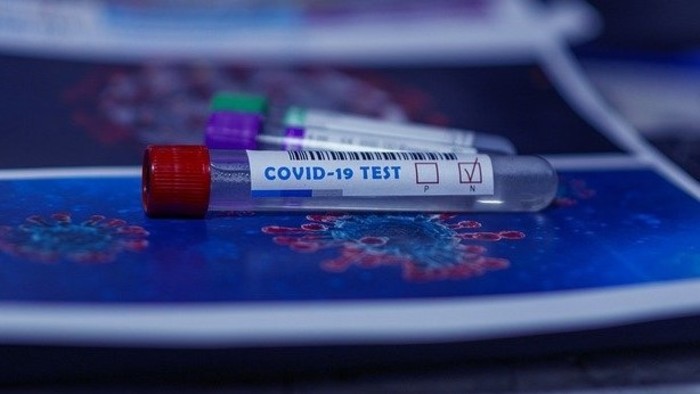 Kľúčový bude po testovaní aj prístup pozitívnych ľudí