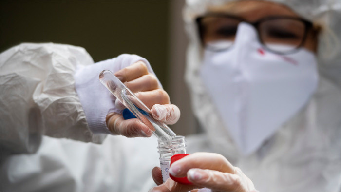 Словения заинтересована в словацких PCR-тестах 