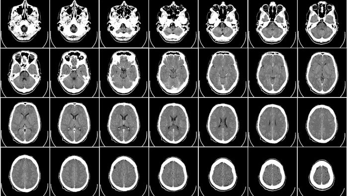 UNLP Košice má prvý ortopedický digitálny panel na Slovensku