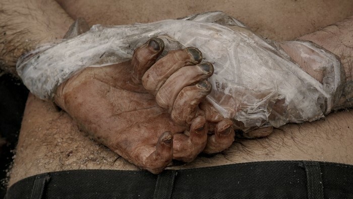 Slovak representatives condemn Bucha massacre 