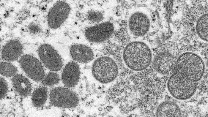 Se confirma el primer caso de viruela del mono en Eslovaquia