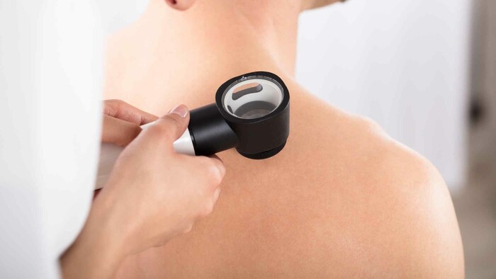 Vyšetrenie kože a znamienok v rámci prevencie