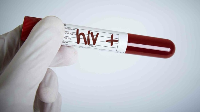 Dočkáme sa vakcíny proti HIV? 