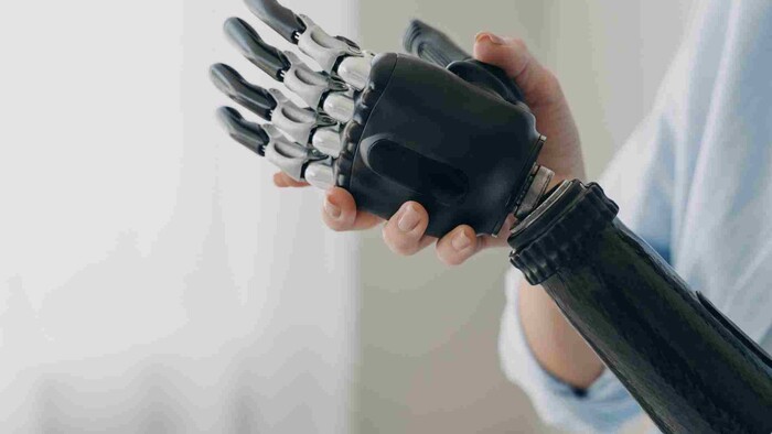 Robotická rehabilitácia