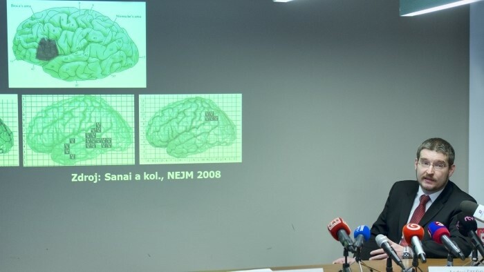 Hospital de Trnava utiliza con éxito nueva técnica de cirugía cerebrovascular