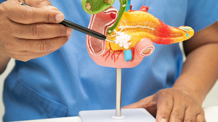 Transplantácia pankreatických ostrovčekov