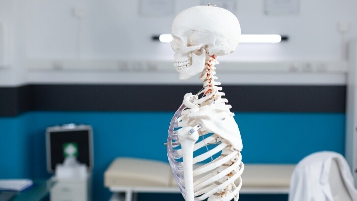 Čo vie odhaliť denzitometria?