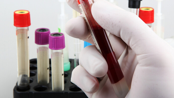 Umelá laboratórna krv 