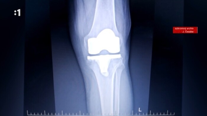 Invalid bez invalidity