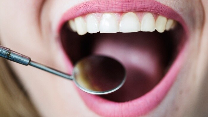 Kreatín obnovuje zubnú sklovinu