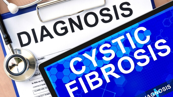 Zmeny v úhrade modernej liečby cystickej fibrózy