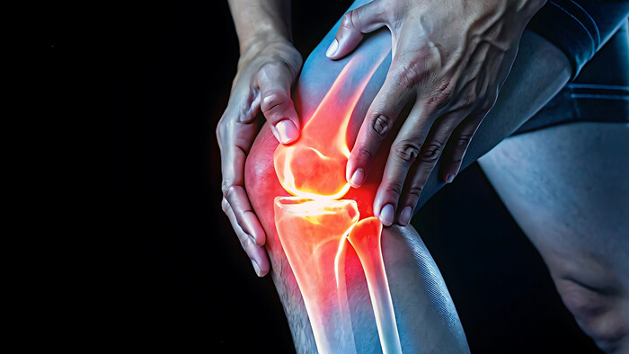 Nová liečba chrupavky v kolene