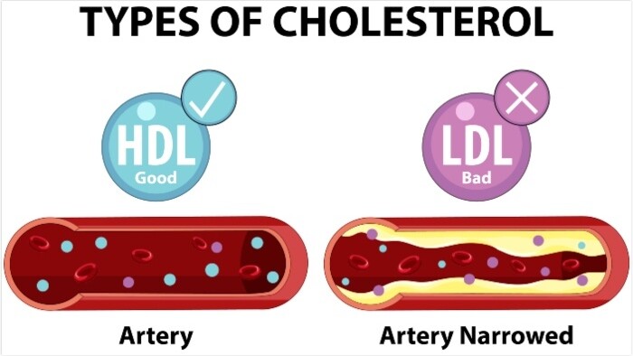 Dobrý a zlý cholesterol
