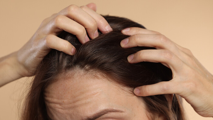 Nádej pre vypadávanie vlasov 