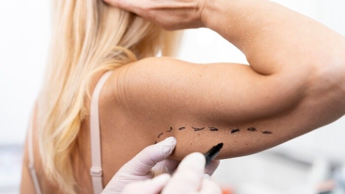 Záujem o estetickú plastickú chirurgiu rastie