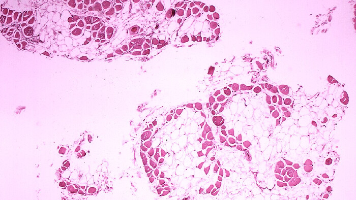 Druhá šanca na život pre Vilka