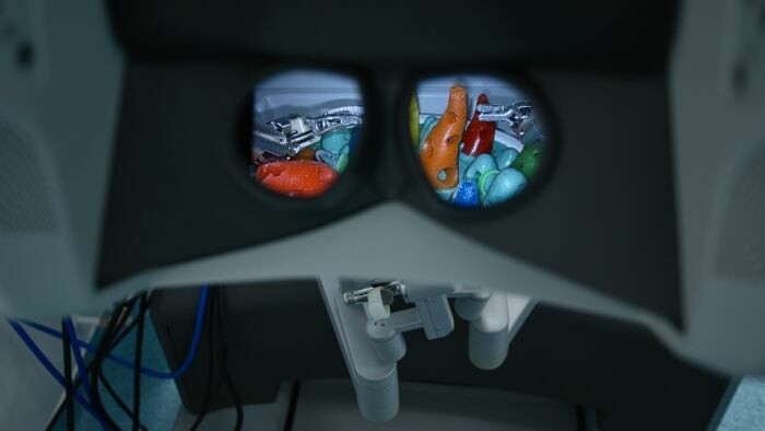 Transplantation rénale mère-fille à l'aide d'un robot