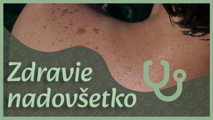 Pigmentové škvrny | Zdravie nadovšetko