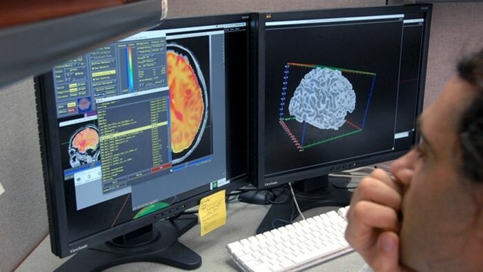 Investigación de neurocirujanos eslovacos es reconocida en EE UU