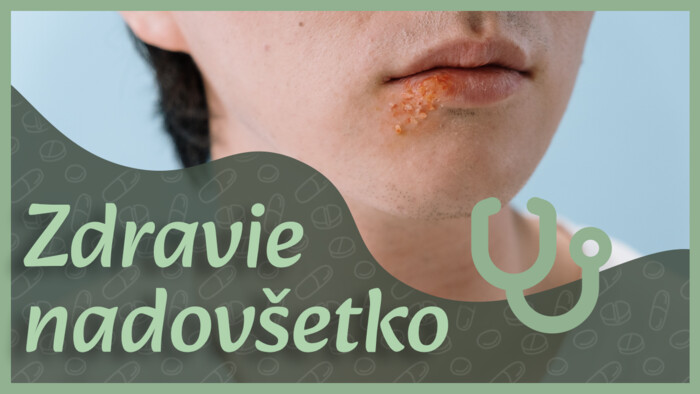 Herpes | Zdravie nadovšetko