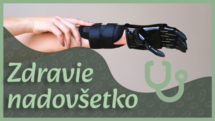 Protéza palca ruky | Zdravie nadovšetko