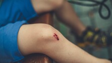 Plač a krik dieťaťa ešte nemusí znamenať vážne zranenie. V takom prípade pomôže nová zdravotnícka linka