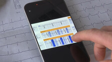 Aplikáciu, ktorú vyvinuli Slováci, využívajú aj lekári v zahraničí. Infarkt dokáže odhaliť za niekoľko sekúnd